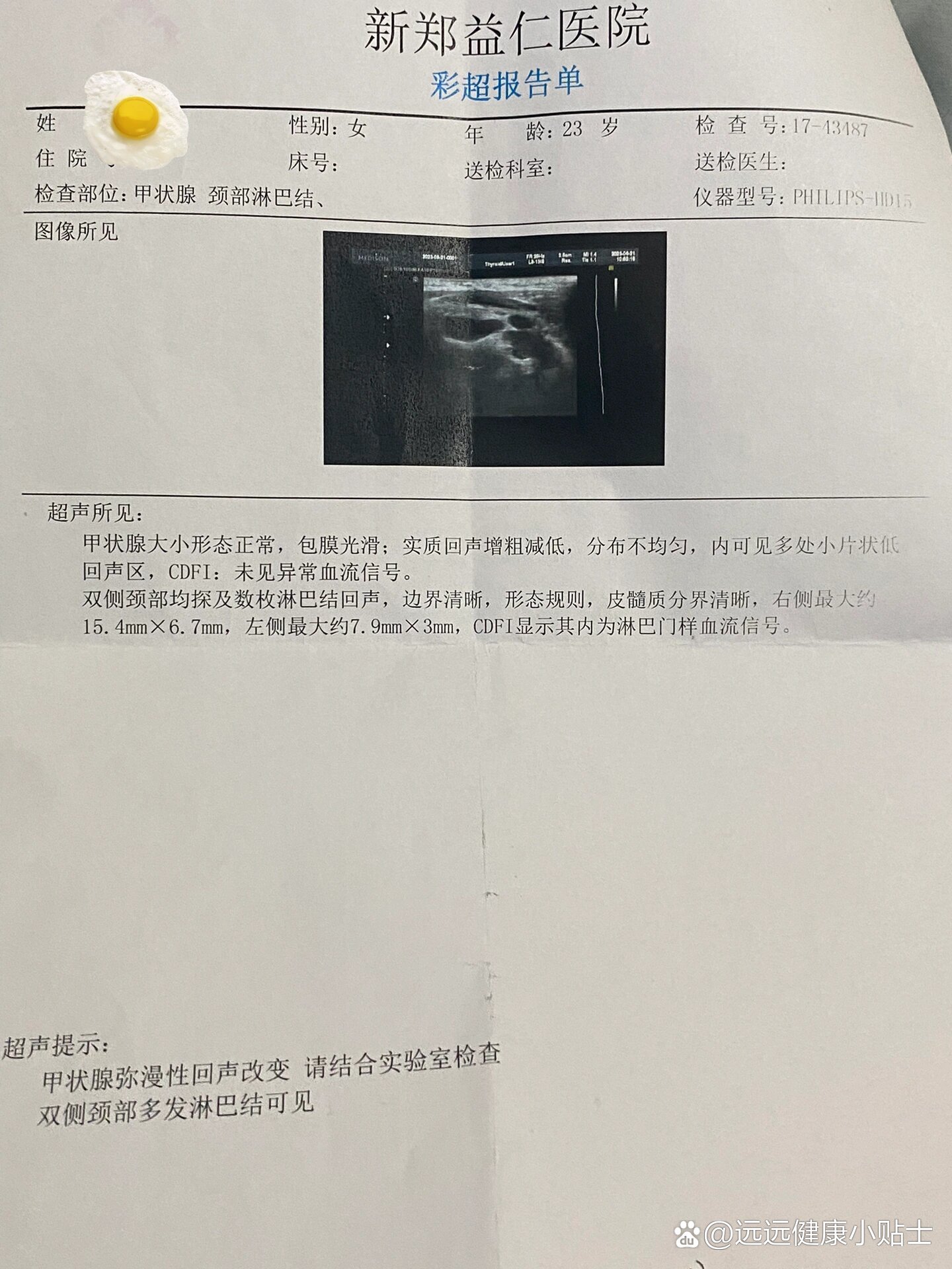 河南新增本土98例感染者在郑州等7市-河南新增本土病例1个轨迹