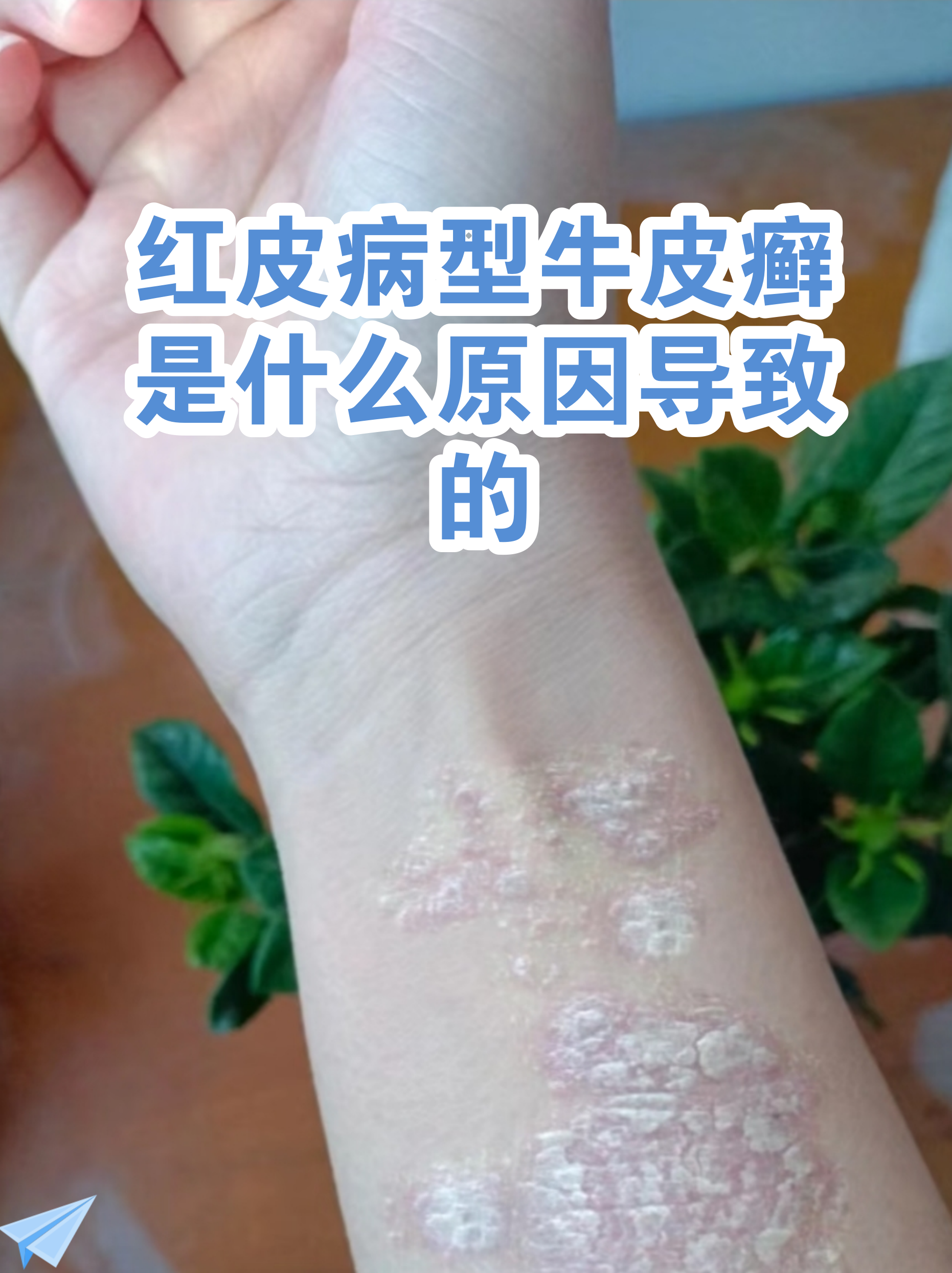 “最新病毒感染2019” 最新病毒感染什么症状？-第3张图片