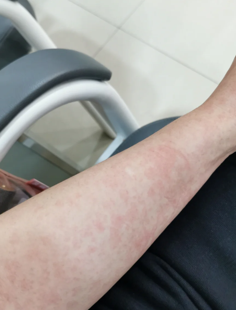 “最新病毒感染2019” 最新病毒感染什么症状？-第2张图片