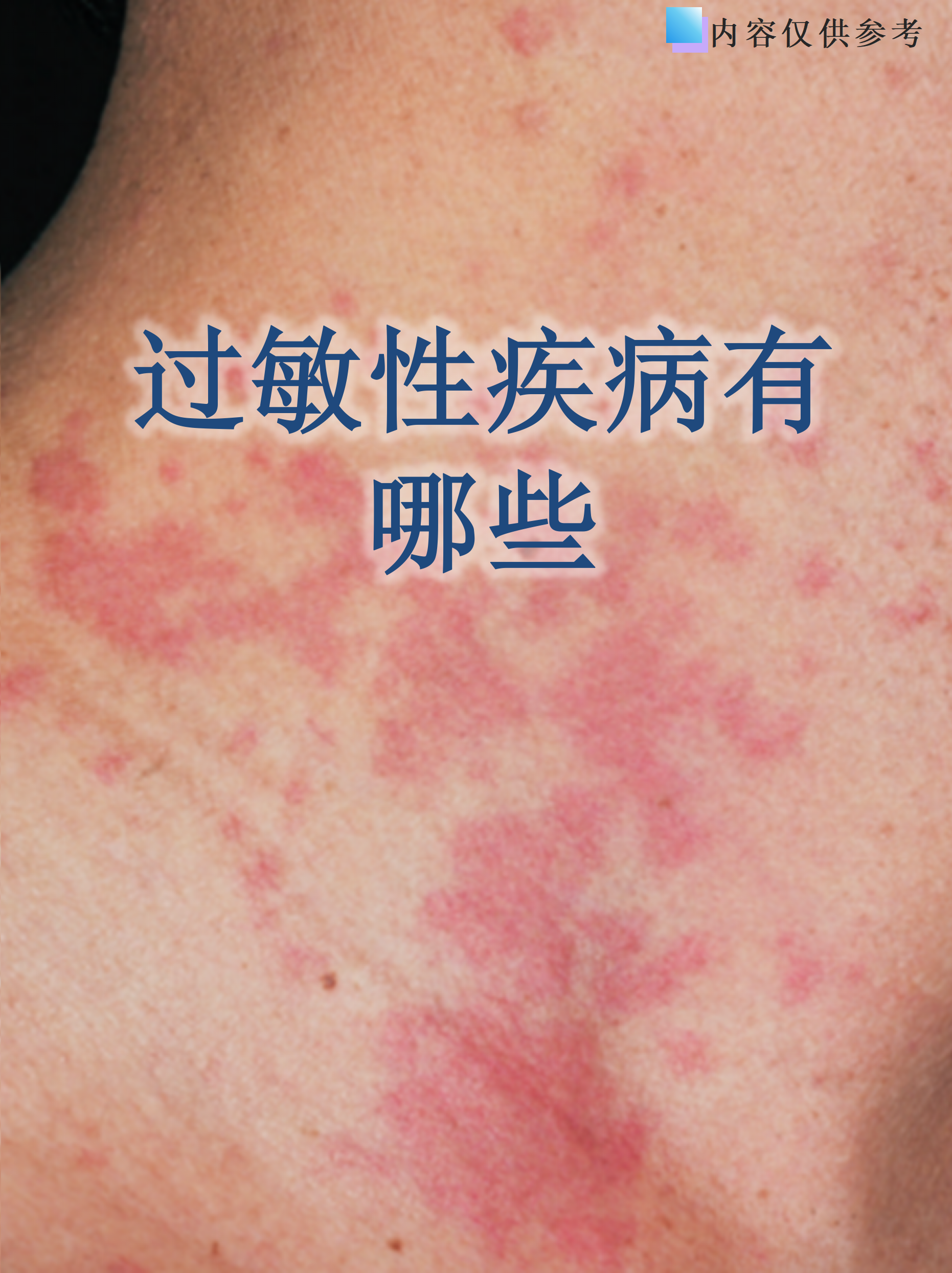 【江苏新增无症状感染者13例/江苏新增4例无症状】-第2张图片