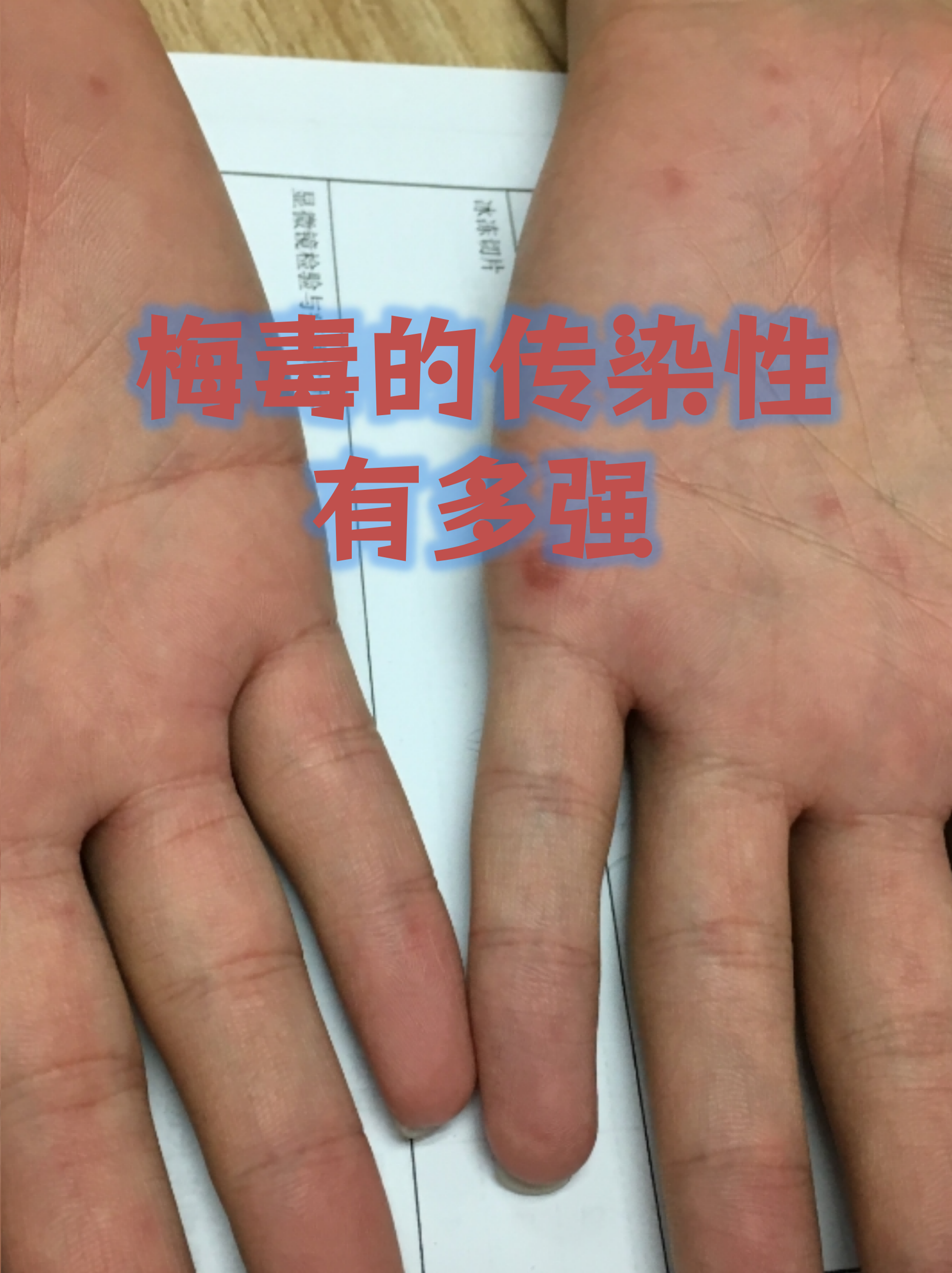 “北京本起疫情初判传播风险高	” 北京疫情现超级传播？-第3张图片